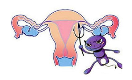 女性阴道炎的感染途径有哪些